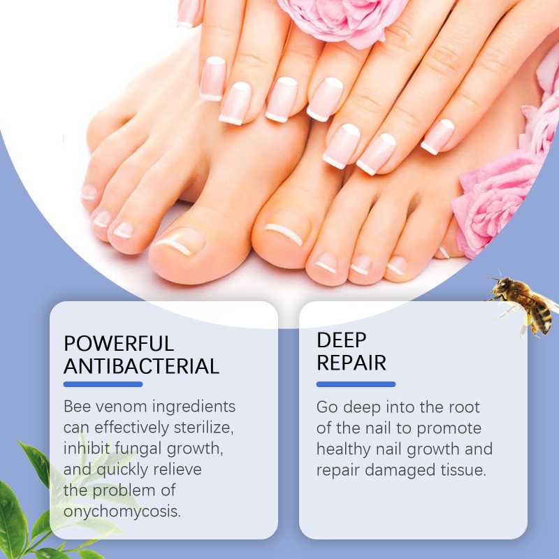 Nail Serum Supplier - Organic Nail Care Solution Nourishing Fungus Treatment Deep Repair Serum