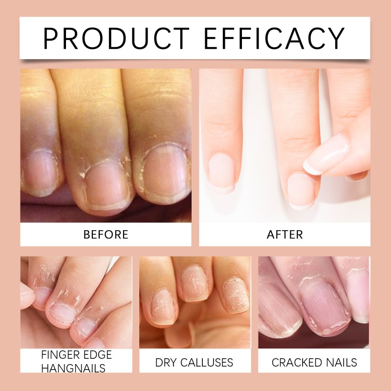 Nail Balm Manufacturer - 3 in 1 Nail Hand Callus Remover Pedicure Repair Exfoliating Peach Balm