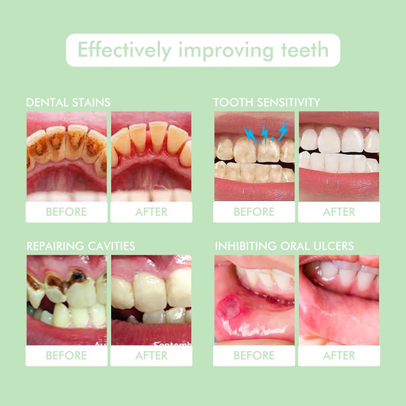 Mouthwash Manufacturer - New Arrival Dental Care Teeth Whitening Yellow Stains Remove Fruity Mouthwash