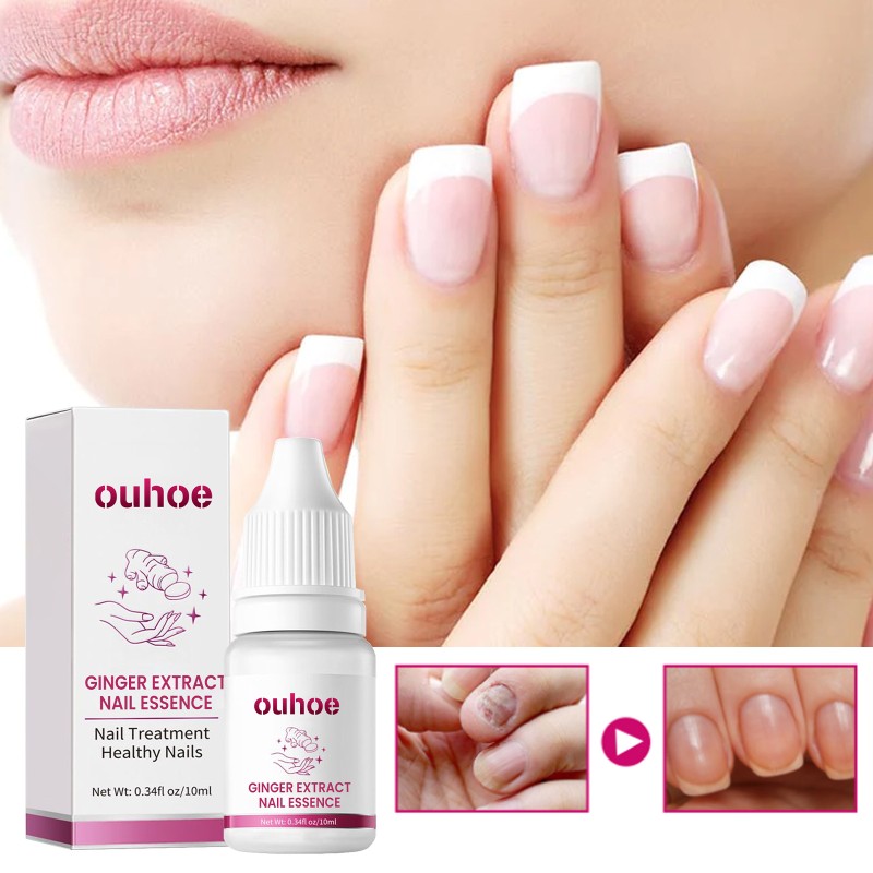 Nail Serum Supplier - Nail Treatment Fungal Nail Repair Rough Promote Growth Ginger Liquid Serum