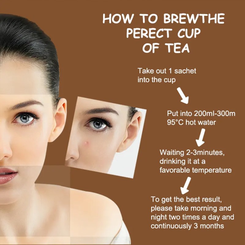 Acne Tea Bag Supplier - Portable Acne Tea Bag 100% Herbal Supplement Acne Tea Skin Beautiful Health