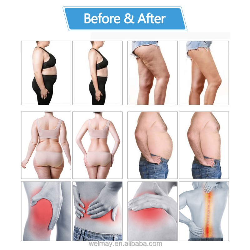 Ultrasound Hifu Machine Supplier - Portable Body Shape Weight Loss 8mm 13mm Ultrasonic Warranty