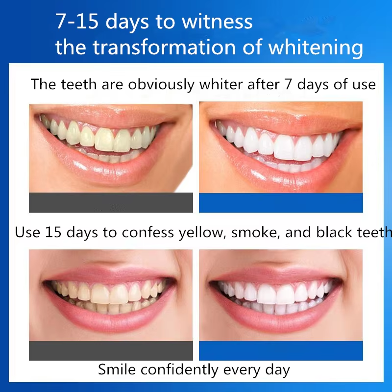 Adult Whitening Strips Manufacturer - Kit Double Care Transparent Tooth Whitening Strips