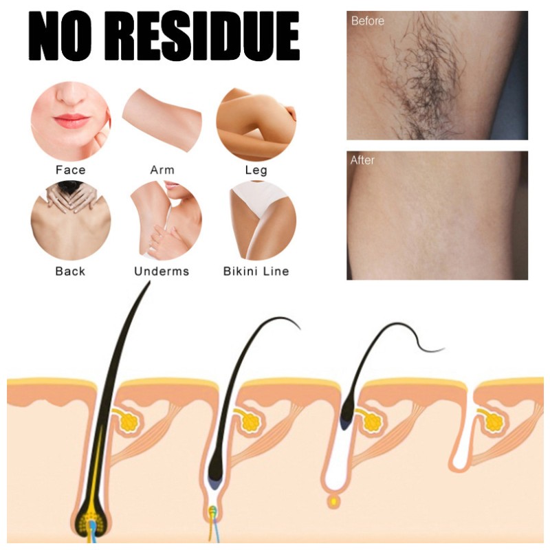 Hair Removal Strips Factory - Popular Summer Product for Women Face Body Home Use Wax