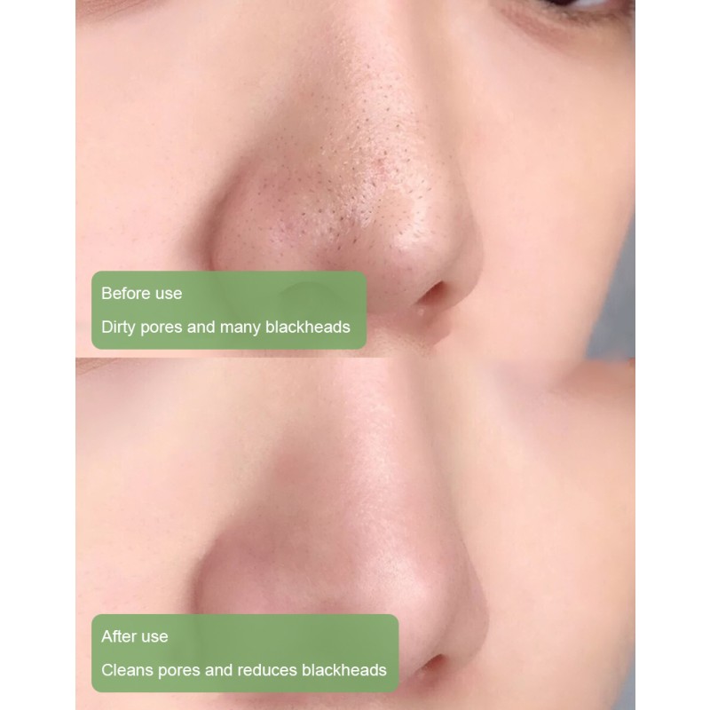 Solid Face Mask Stick Manufacturer - Custom Green Tea Oil Control Moisturizing Acne Remove