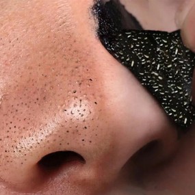 Nose Strips Supplier - Stock Female/Male Blackhead Remover Patch Cotton Sheet Convenient