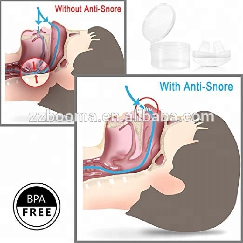 Magnetic Nose Clip Factory - Hot Selling Anti Snoring Snore Free Magnetic Silicone Sleeping Device