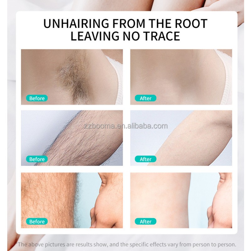 Hair Remover Cream Supplier - OEM/ODM Stop Hair Grow Herbal Remover for Men Women Permanent