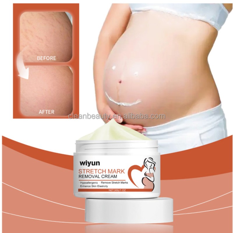 Skin Repair Cream Supplier - Wholesale Healthcare Supply Skin Repair Cream for Stretch Mark Scar Removal