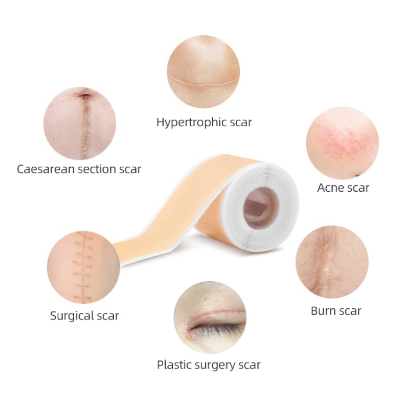 Scar Tape Factory - Medical Grade Silicone Scar Tape Self Adhesive for Hypertrophic Scars