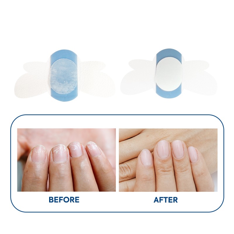 Nail Repair Patch Manufacturer - 2025 Customized Keratin Deep Moisturizing Nail Repair Nutrition Patch Hot Sell Beauty