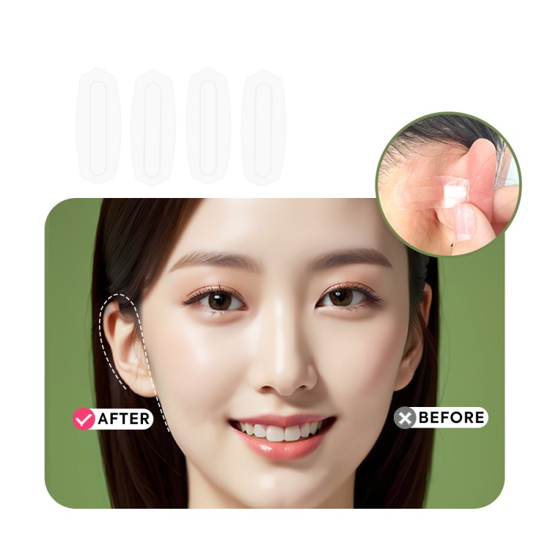 Ear Corrector Factory - High Quality Elf Ear Corrector Stickers for Rehabilitation Therapy Cosmetic Ear Correction