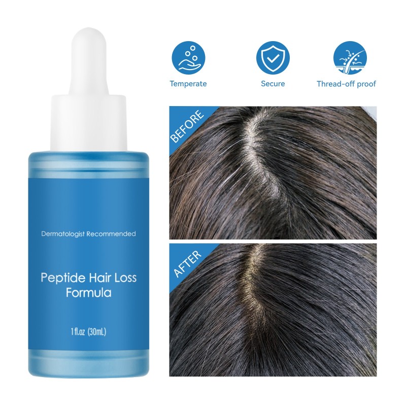 Hair-Loss Prevention Manufacturer - 20ML Private Label Hair Growth Hair-Loss Prevention Oil Repair Smoothing Scalp Wellness