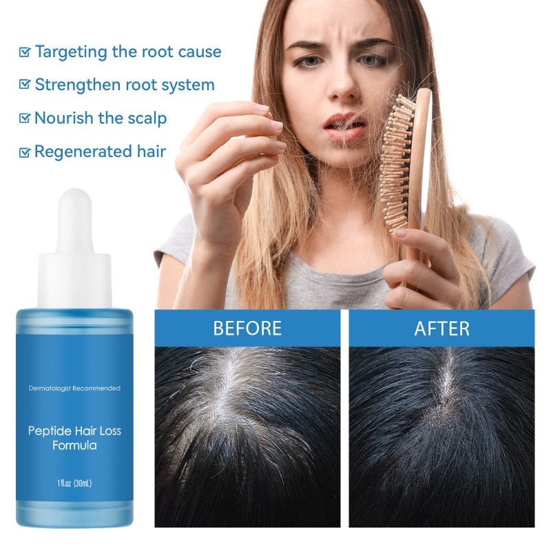 Hair-Loss Prevention Manufacturer - 20ML Private Label Hair Growth Hair-Loss Prevention Oil Repair Smoothing Scalp Wellness