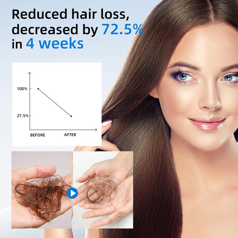 Hair Growth Oil Supplier - 20ML Private Label Hair Care Natural Anti Hair Loss Organic Strength Nourishing Growing Serum