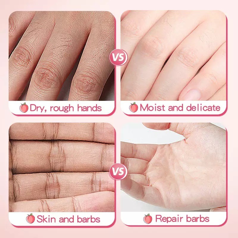 Brightening Cream Supplier - Private Label Wholesale Brightening Lightening Anti-Acne Remove Black Dark Spot Body