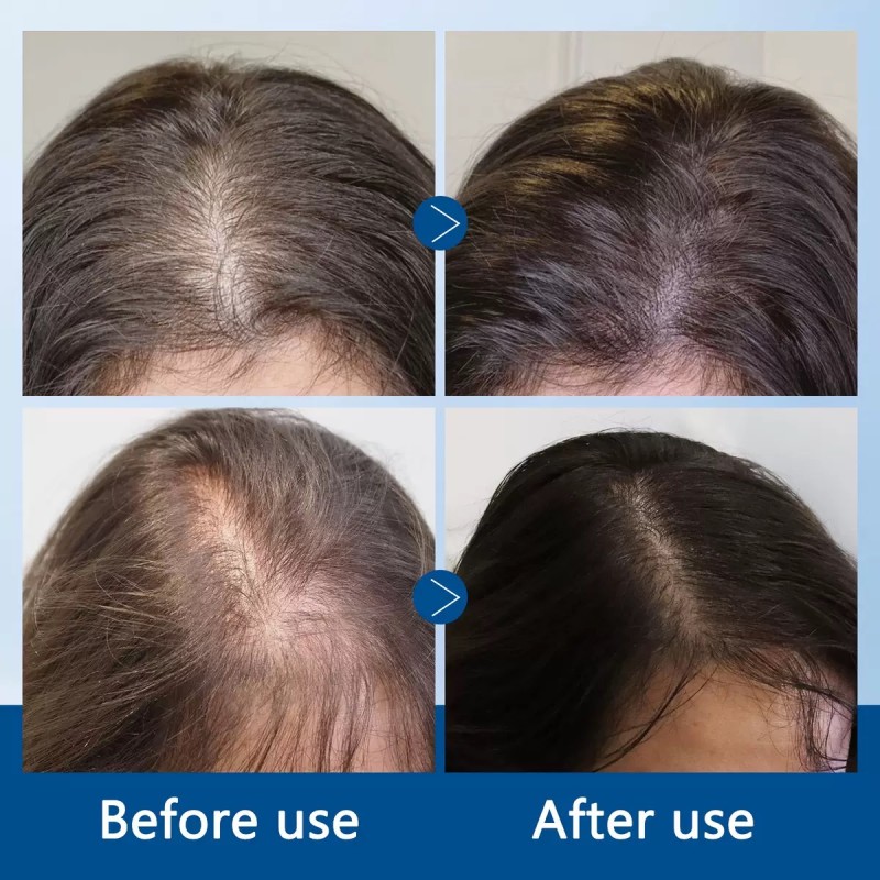 Hair Care Oil Factory - 20ML Private Label Hair Care Natural Organic Prevents Hair Loss Serum Nourishing Growing Strong