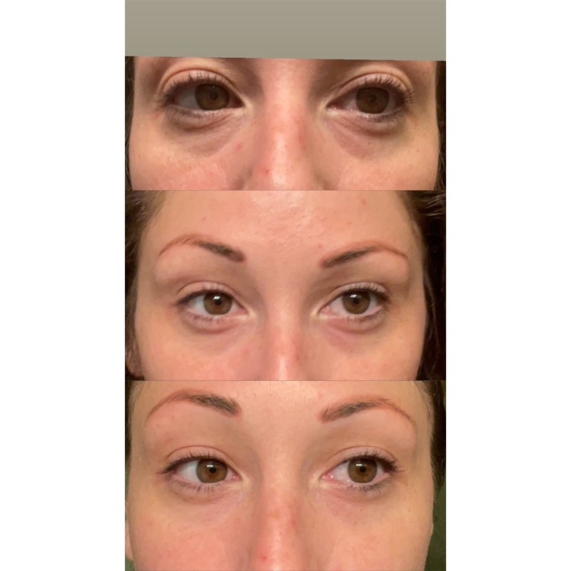 Eye Mask Manufacturer - Wholesale Collagen Eye Mask