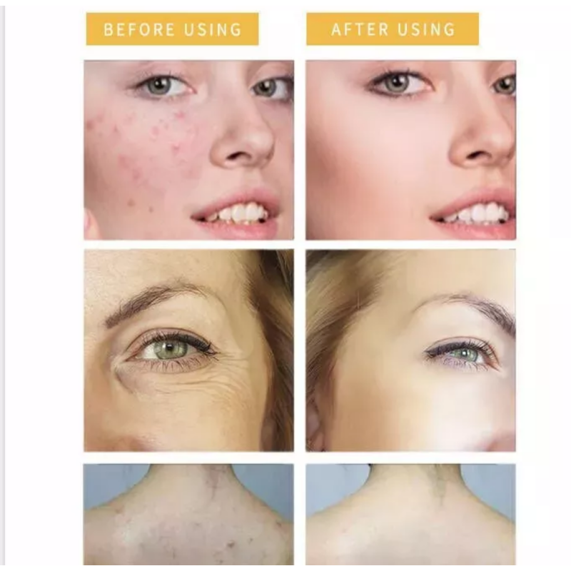 Handmade Soap Factory - Hot Selling Organic Turmeric Soap