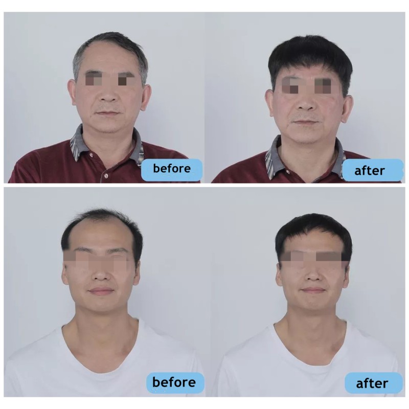 Hair Serum Factory - Wholesale Ginger Regrowth Serum