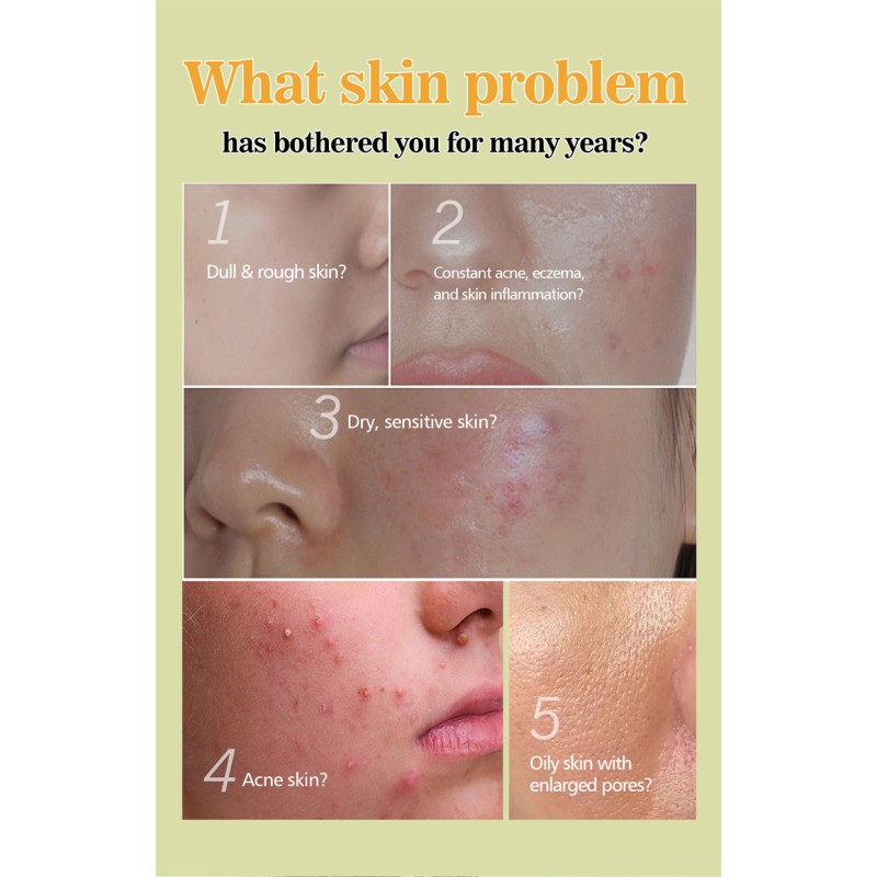 African Soap Manufacturer - Organic Shea Butter Black Soap