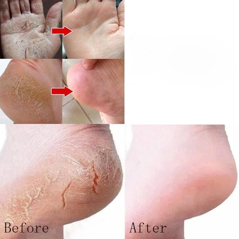 Foot Cream Factory - Professional Horse Oil Shea Butter