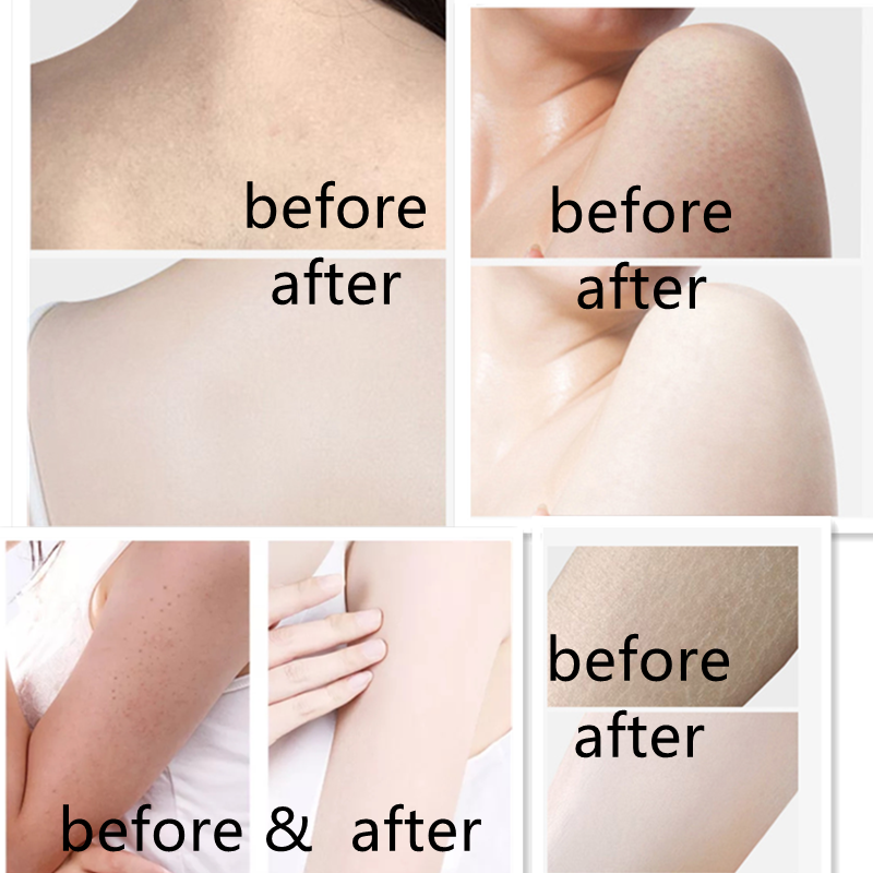 Body Scrub Manufacturer - New Avocado Candy Scrub