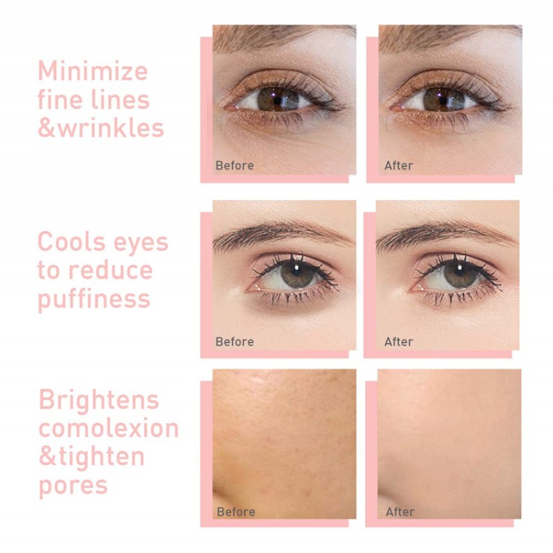 Facial Roller Factory - Private Label Ice Globes