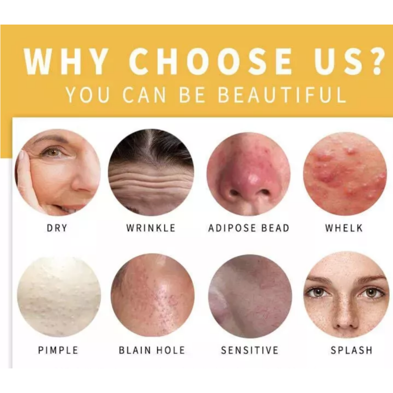 Handmade Soap Factory - Hot Selling Organic Turmeric Soap