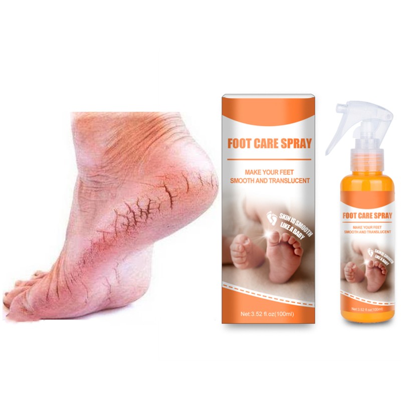 Foot Spray Factory - Private Label Orange Peeling Spray