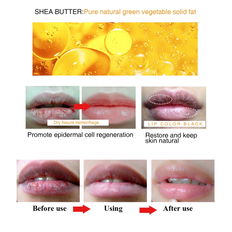 Lip Balm Factory - Whitening Dark Lip Balm