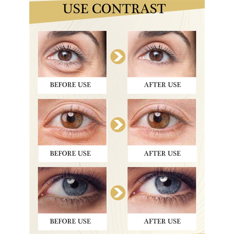 Eye Cream Factory - Instant Eye Bags Removal Cream