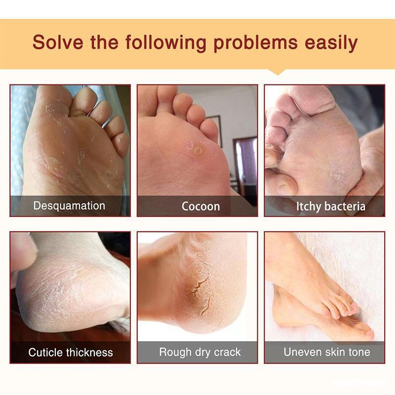 Foot Mask Factory - Private Label Natural Peeling