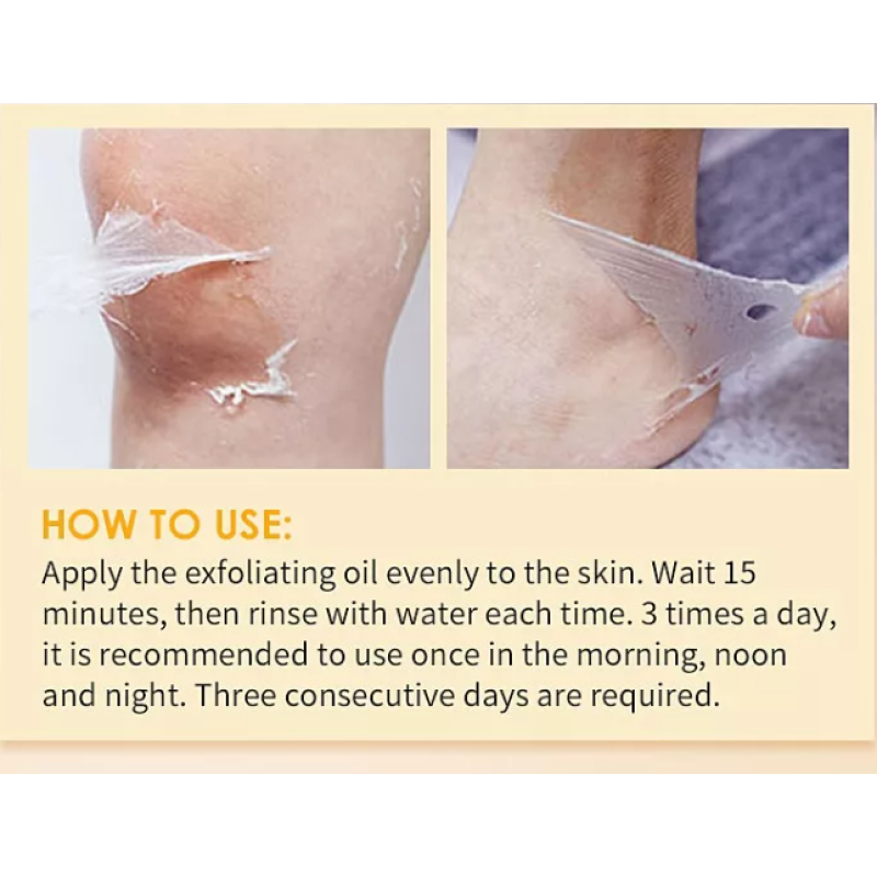 Skin Whitening Oil Factory - Private Label Chemical Whitening Serum Gel Dark