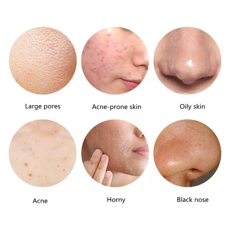 Peeling Soap Supplier - Wholesale 2025 24k Gold Organic Whitening for Skin