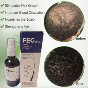 Hair Growth Serum Supplier - Hot Sale Quality Guaranteed Anti Fake 2025