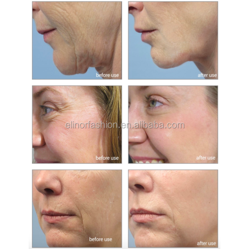 Skin Care Serum Supplier - 2025 24K Gold Serum Whitening Moisturizing Korean