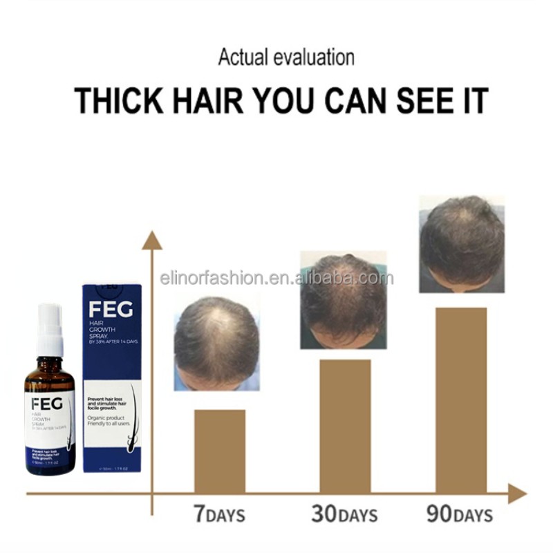 Hair Growth Spray Manufacturer - FEG Pilatory Bald Treatment Stimulate Growth