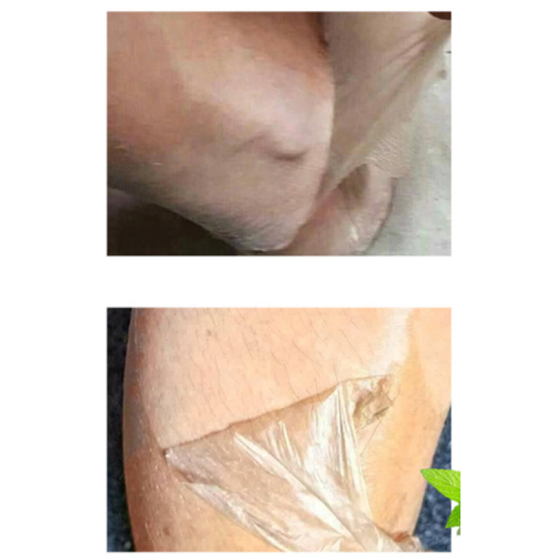 Skin Whitening Oil Factory - Private Label Chemical Whitening Serum Gel Dark