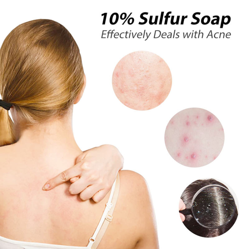 Bleaching Soap Factory - Custom 2025 New Arrival Packaging Organic Whitening