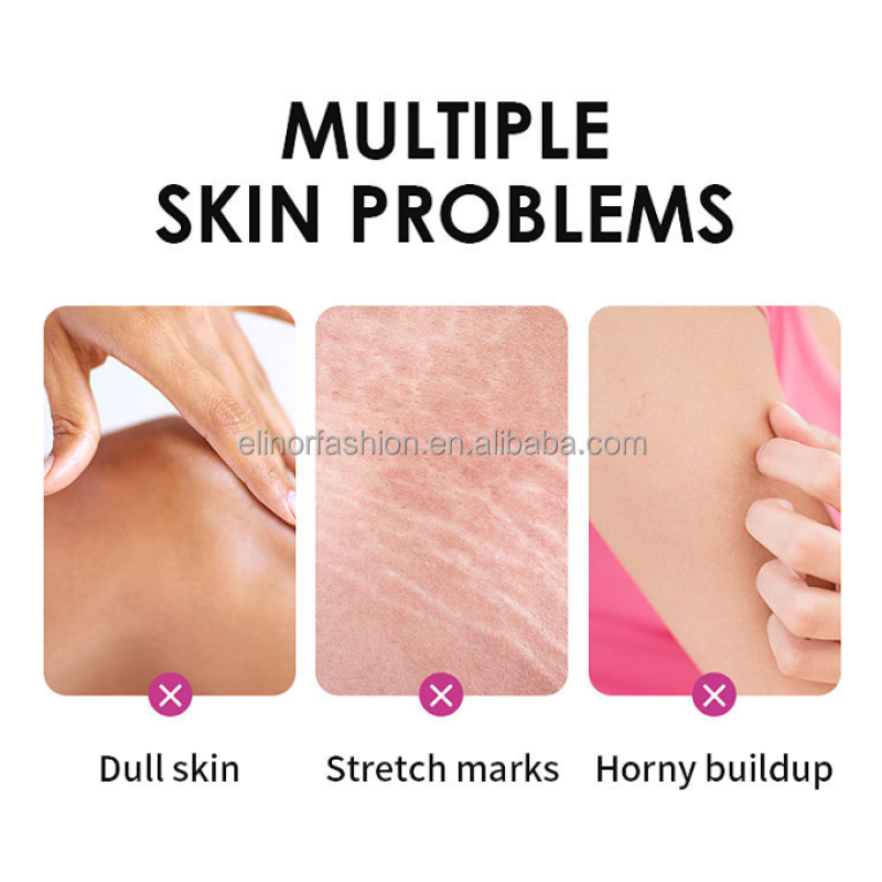 Peeling Oil Manufacturer - Real Yellow Peeling Oil Knuckles Whitening Dead Skin