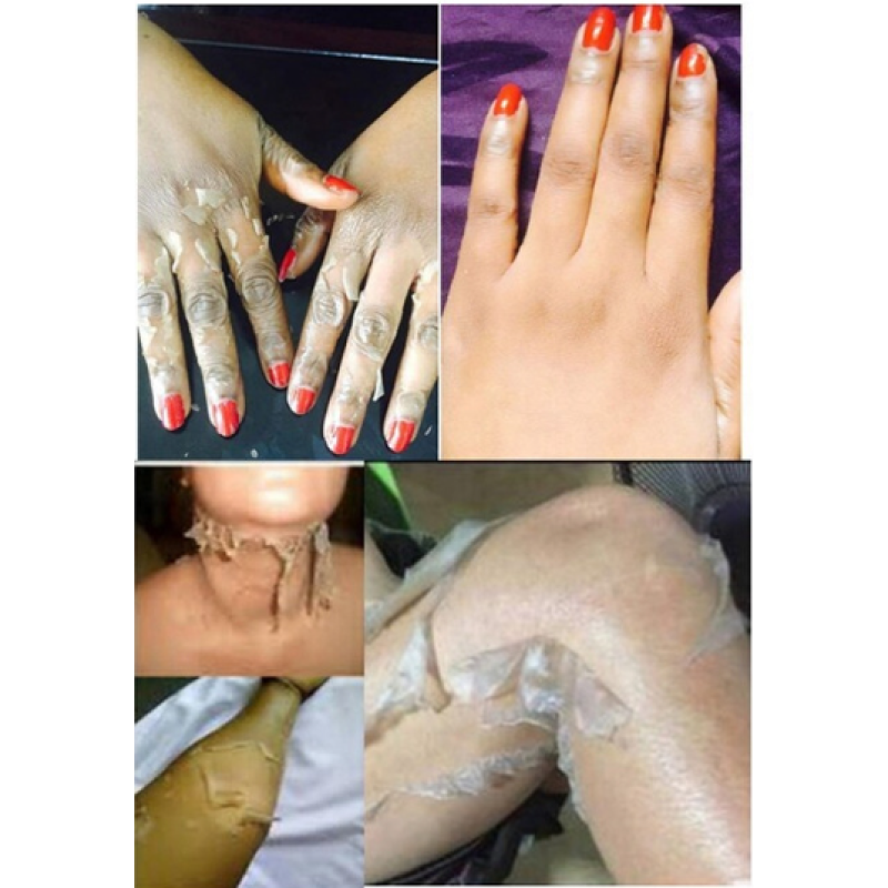 Skin Whitening Oil Factory - Private Label Chemical Whitening Serum Gel Dark