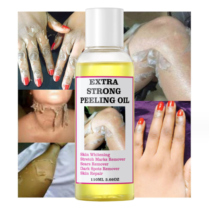 Skin Lightening Oil Factory - Eternal Elinor Organic Yellow Oil Bleaching Private