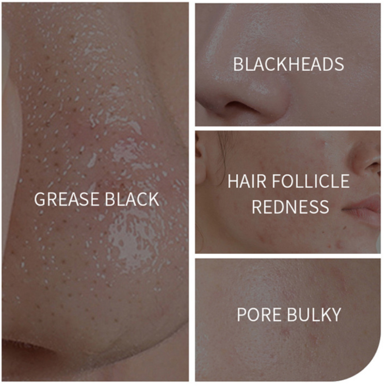 Clay Mask Stick Factory - Custom Organic Blackhead Remove Oil Control Green Tea