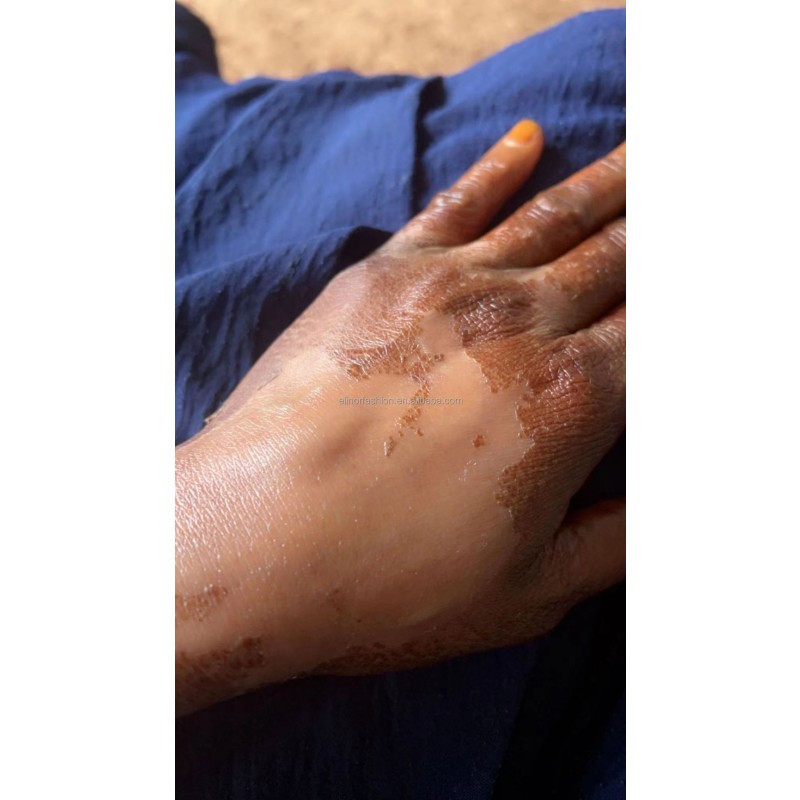 Skin Lightening Oil Factory - Eternal Elinor Organic Yellow Oil Bleaching Private