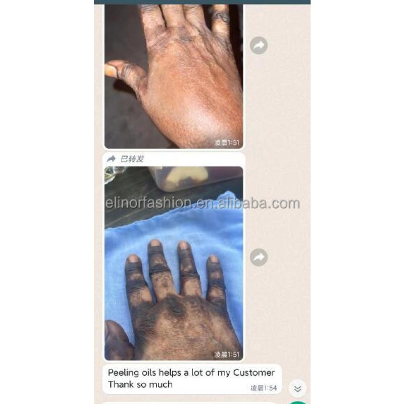 Skin Lightening Oil Factory - Eternal Elinor Organic Yellow Oil Bleaching Private