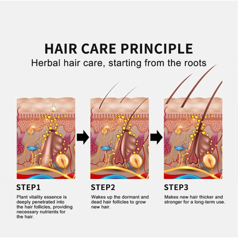 Hair Growth Spray Manufacturer - FEG Pilatory Bald Treatment Stimulate Growth