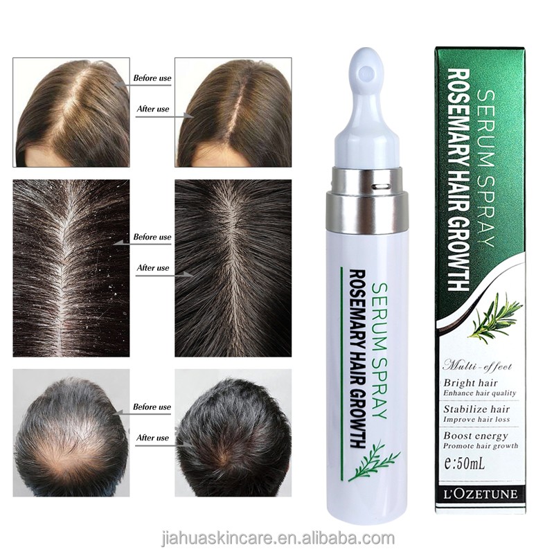 Hair Growth Spray Factory - Private Label Rosemary Spray