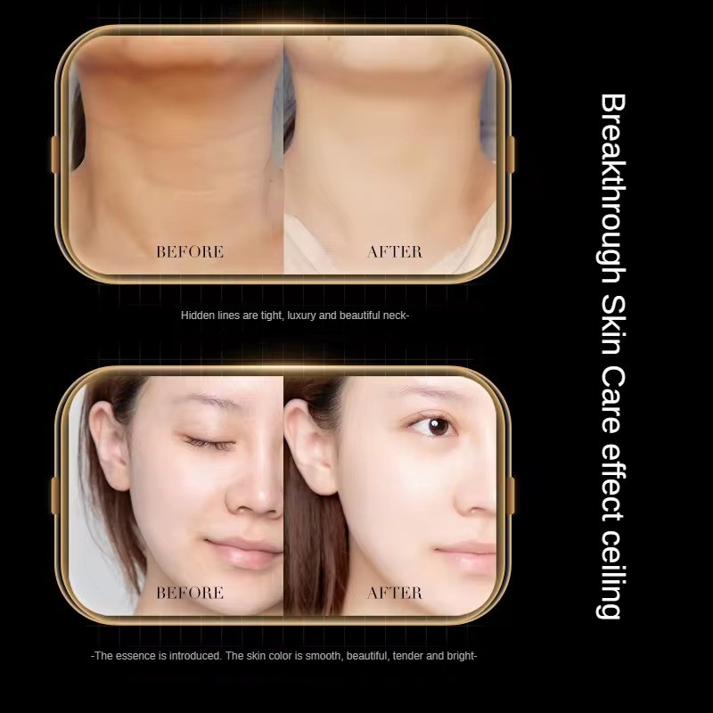 Beauty Massager Supplier - Hot Selling Wholesale OEM Face and Neck Lifting Electric Household Massager