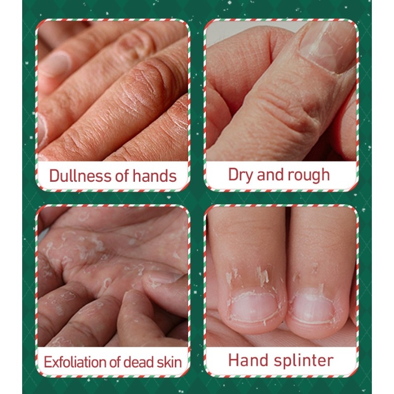 Hand Cream Set Supplier - SADOER Five-Piece Set Autumn Winter Organic Christmas Gift Box Moisturizing